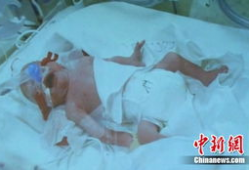 分娩过程视频,揭秘母爱奇迹的瞬间